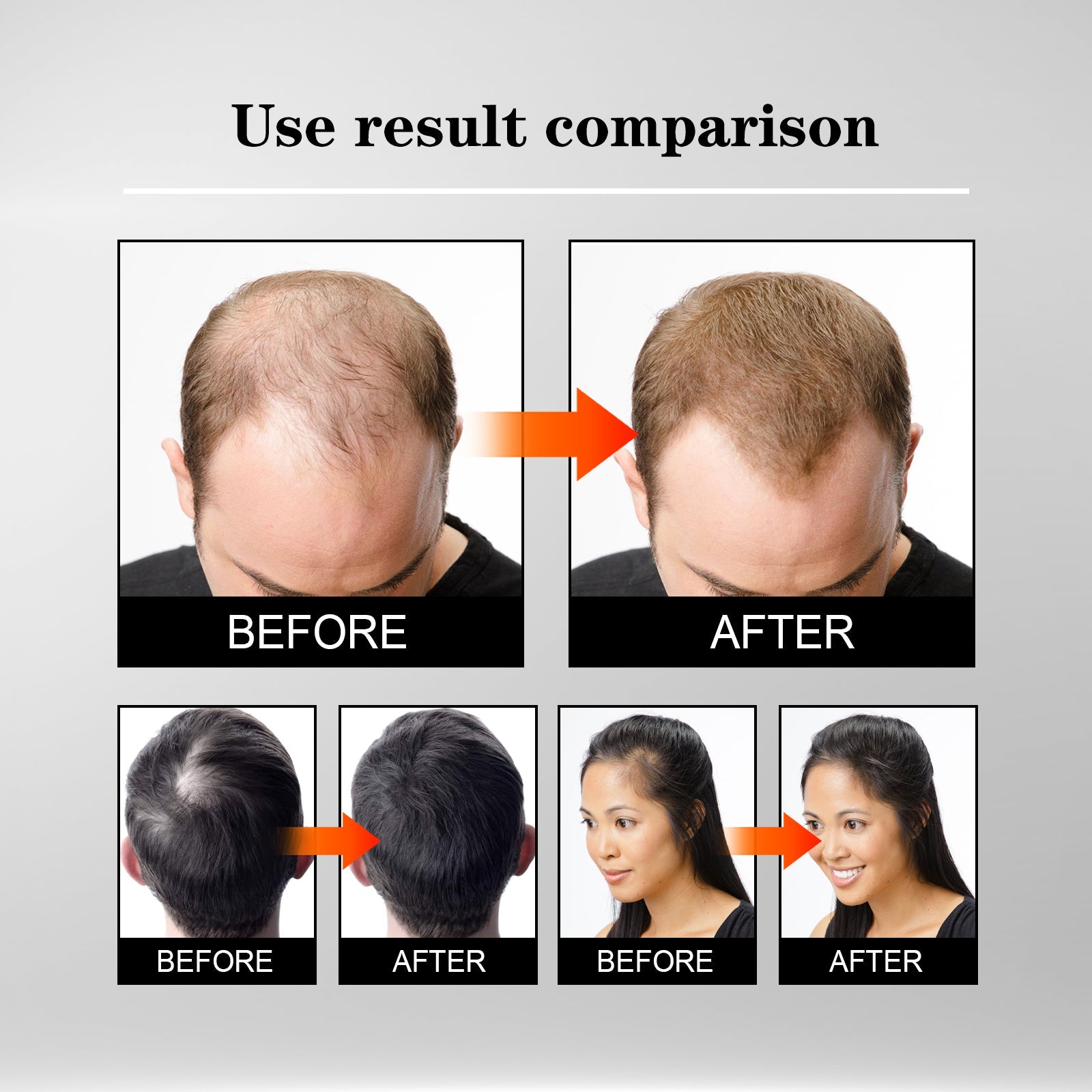 East Moon Hair thickening liquid