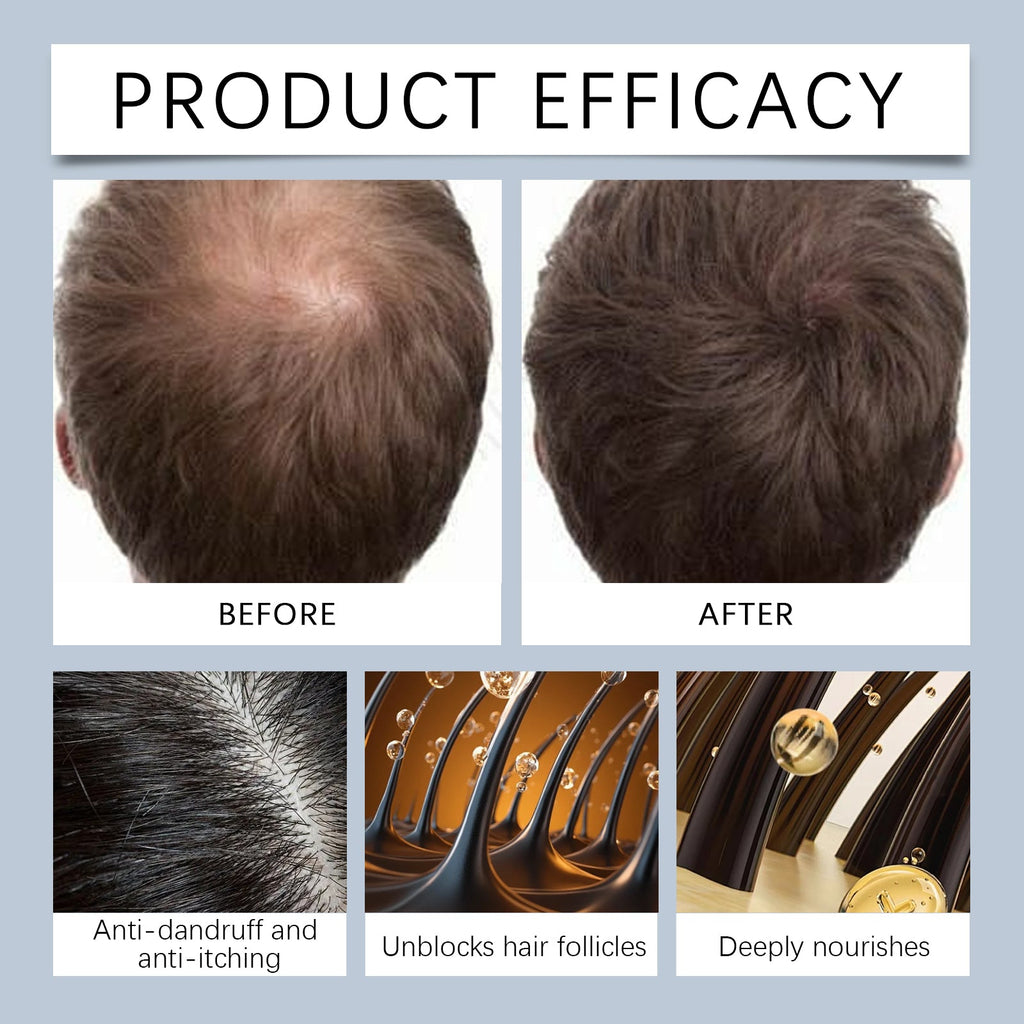 Hoegoa Men's hair rolling essence